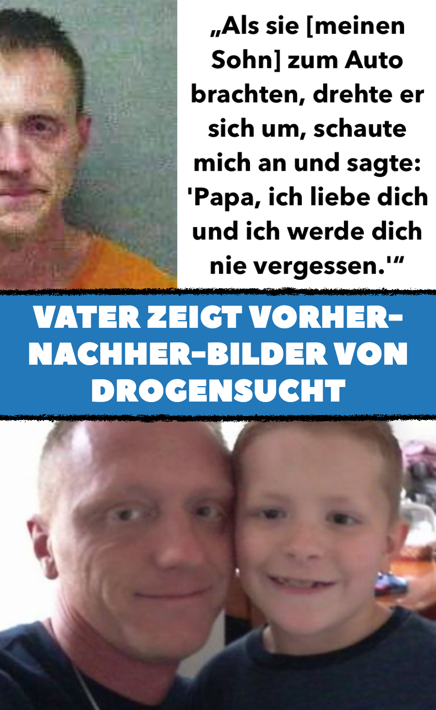 Ex-Junkie zeigt Vorher-nachher-Bilder