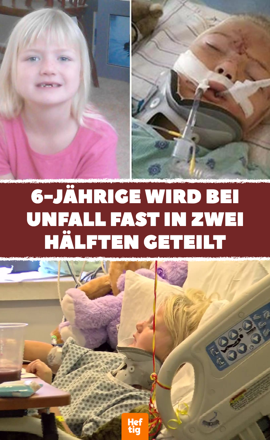 6-Jährige wird bei Unfall fast in 2 Hälften geteilt