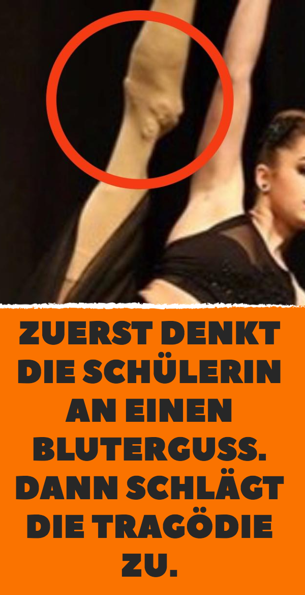 Zuerst denkt die Schülerin an einen Bluterguss. Dann schlägt die Tragödie zu.