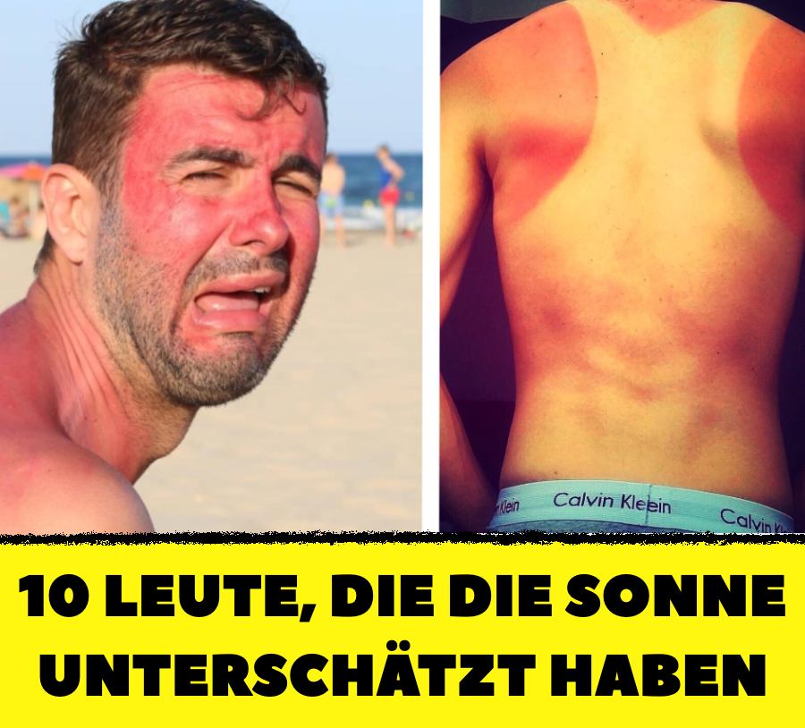 10 Leute, die die Sonne unterschätzt haben