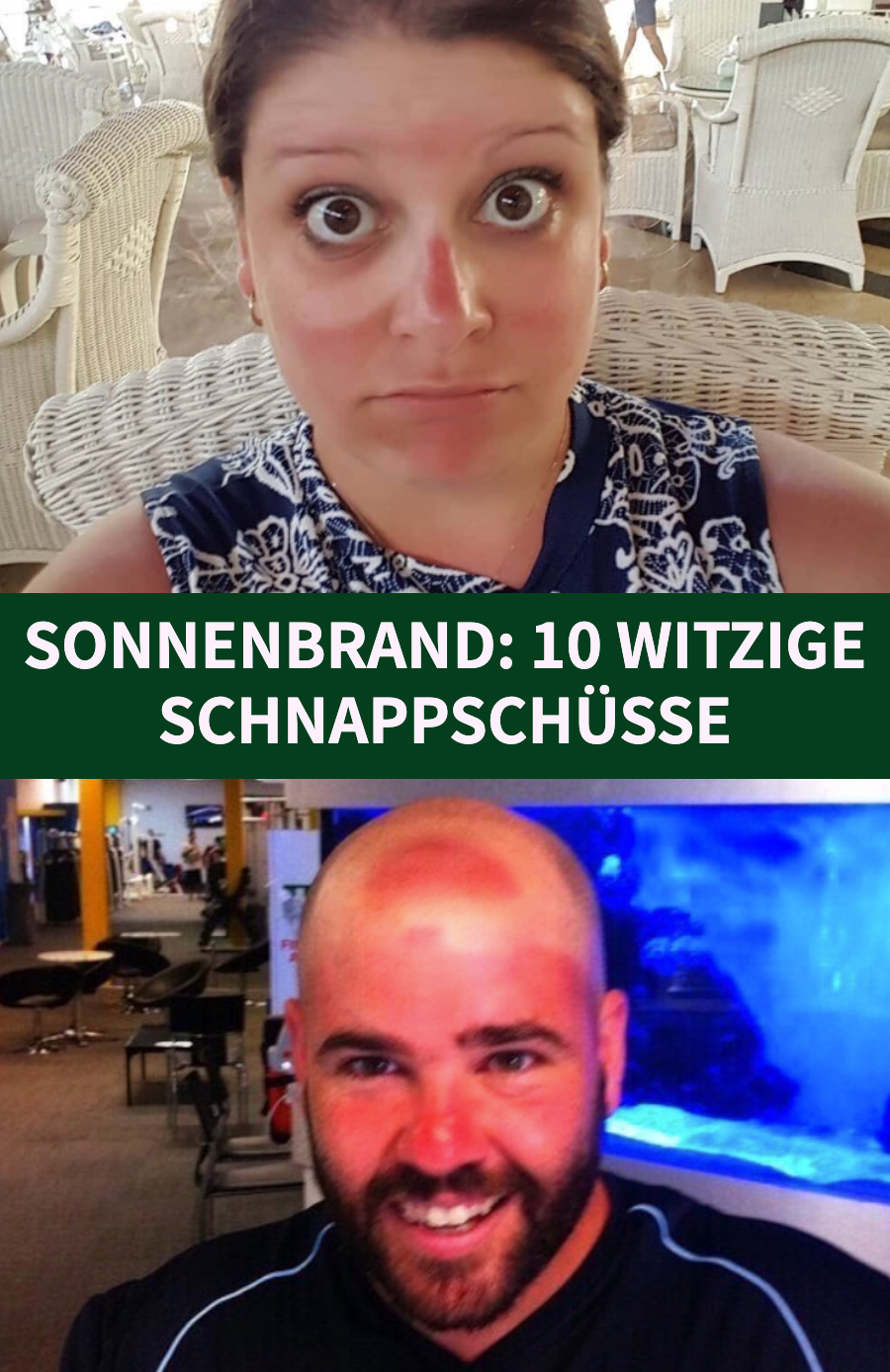 10 Leute, die die Sonne unterschätzt haben