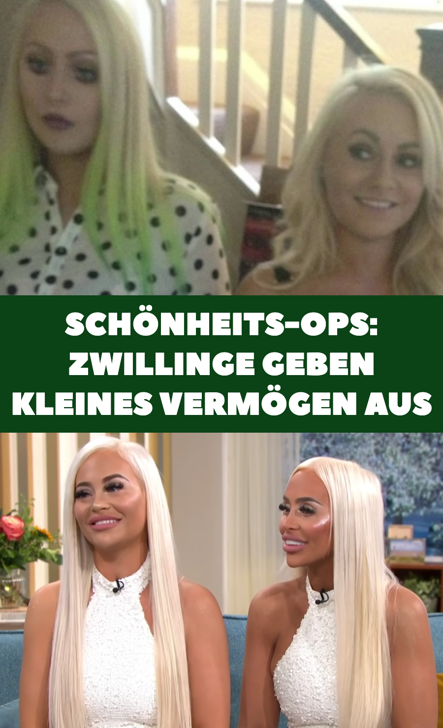 Schönheits-OPs: Zwillinge wollen wie Barbie aussehen